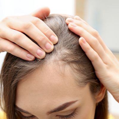Is Mounjaro Causing Your Hair Loss?